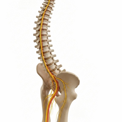Detailed diagram of a healthy human spine and sciatic nerve, illustrating nerve pathways.